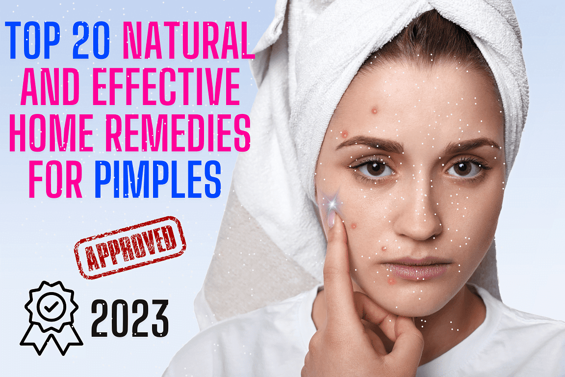 Top 20 Natural and Effective Home Remedies for Pimples Treatment